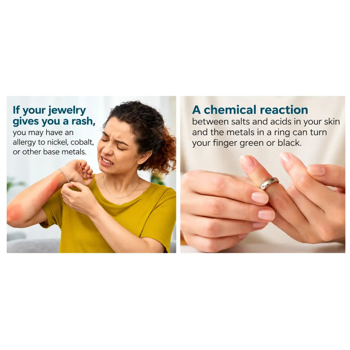 Educational images explaining metal jewelry sensitivity and green skin discoloration caused by metal reactions